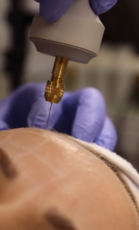 Hot plasma Singapore &mdash; MAX TIGHT & LIFT Structural Reset at Roses & More Skin Alchemy Tanjong Pagar