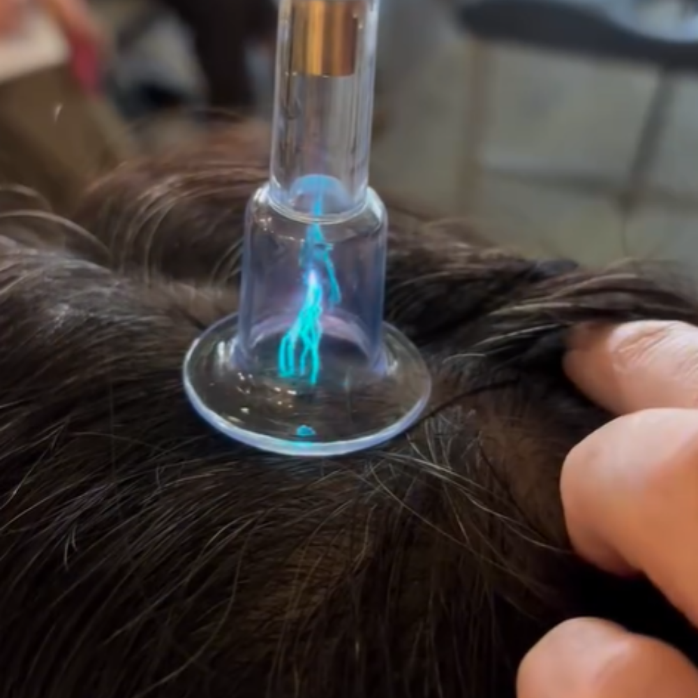 Hair scalp treatment Singapore &mdash; ROOT REVIVE at Roses & More Skin Alchemy